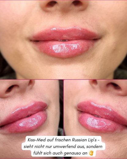Kiss-Med Lipcare, 10ml